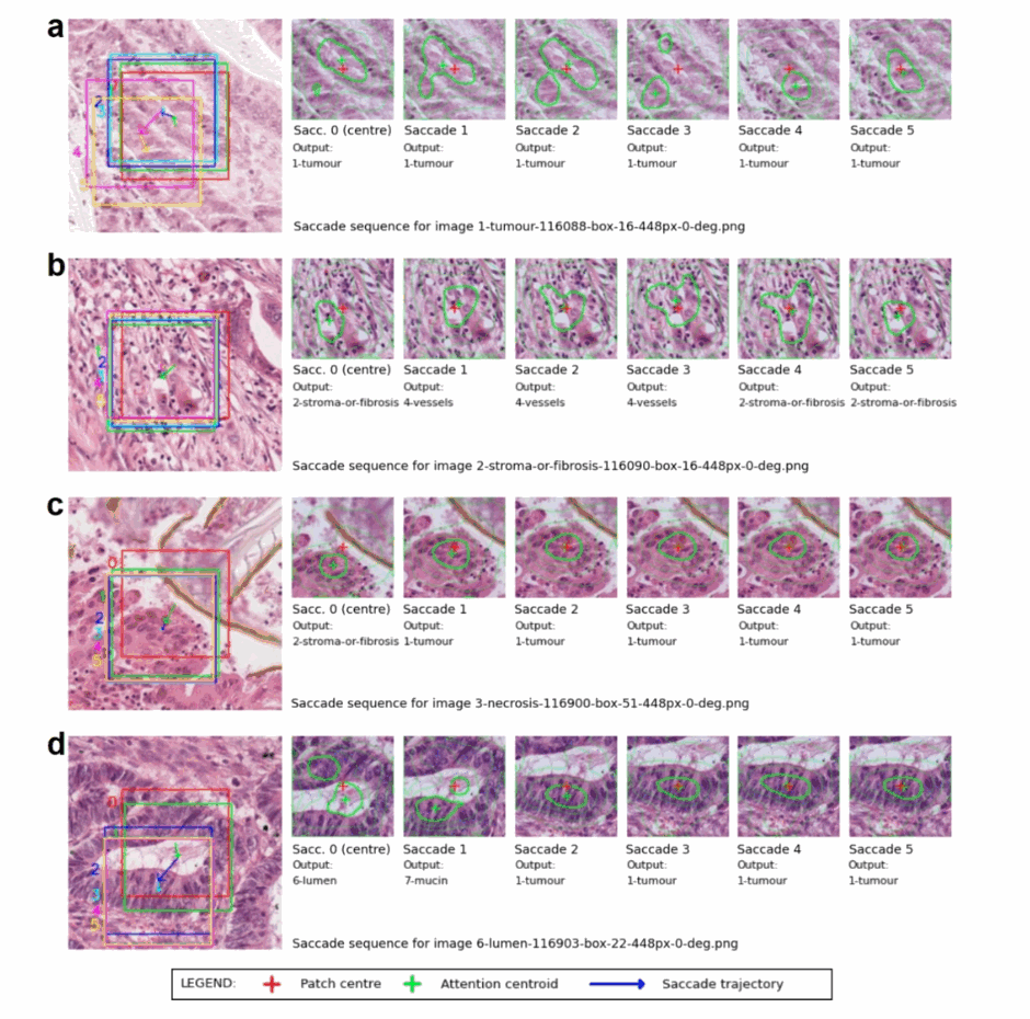 Four rows of histopathology patches, each showing a sequence of six saccades. Coloured boxes mark the attended region, a red cross the patch centre, a green outline the attention centroid, and blue arrows the saccade trajectory; under each patch is the network's class output.